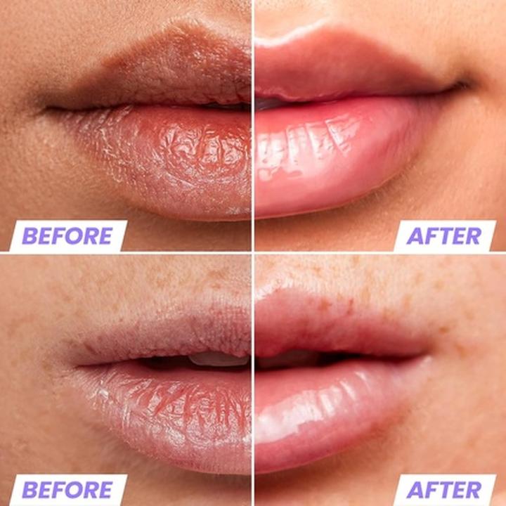 Actual product image Wonderskin Lip Rehab Therapy Oil Clear (Lip oil, 3.57 ml)