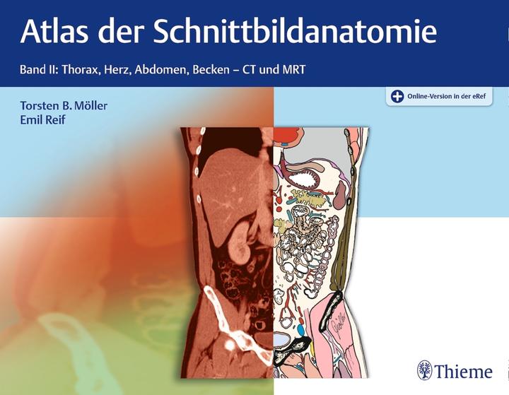 Produktbild Atlas der Schnittbildanatomie (Deutsch, Emil Reif, Torsten Bert Möller, 2018)