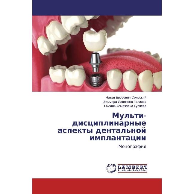 Mul'ti-disciplinarnye aspekty dental'noj implantacii, Fachbücher von Oxana Almazovna Gulyaeva