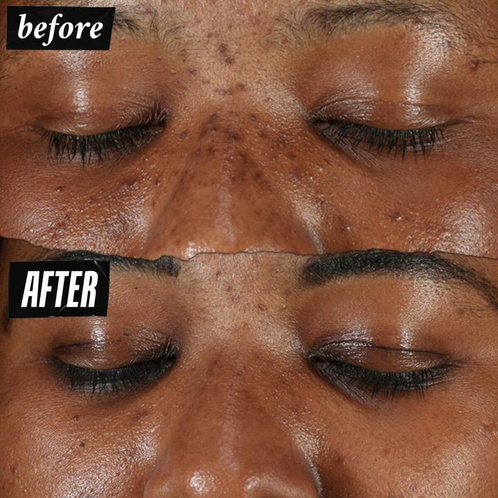 Actual product image Kiehl's Clearly Corrective Dark Spot Solution (100 ml)