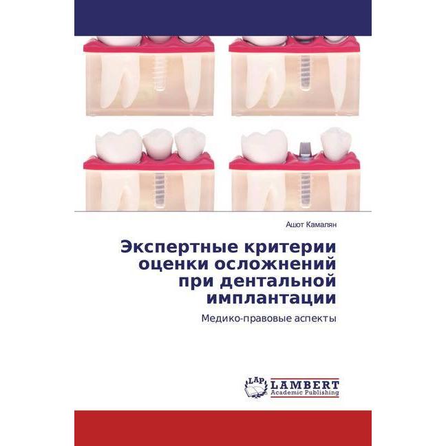 Jexpertnye kriterii ocenki oslozhnenij pri dental'noj implantacii, Fachbücher von Ashot Kamalqn