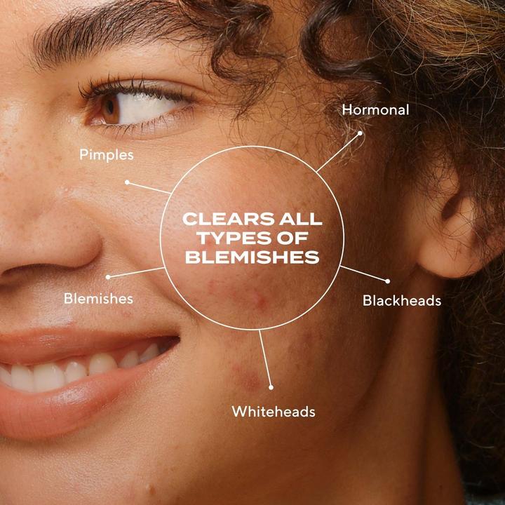 Immagine prodotto Murad Blemish Control (30 ml)