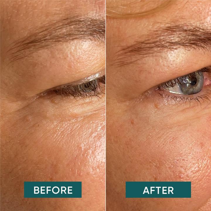 Actual product image Apricot wiederv Augenschl Pad aloe the 2 (Eye patches, 21.67 ml)