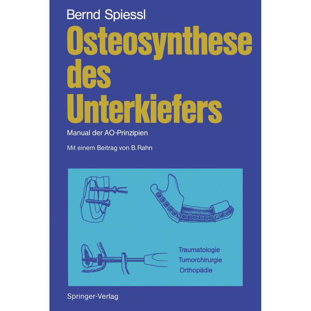 Osteosynthese des Unterkiefers, Fachbücher von Bernd Spiessl
