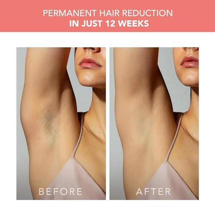 Produktbild Foreo Peach 2