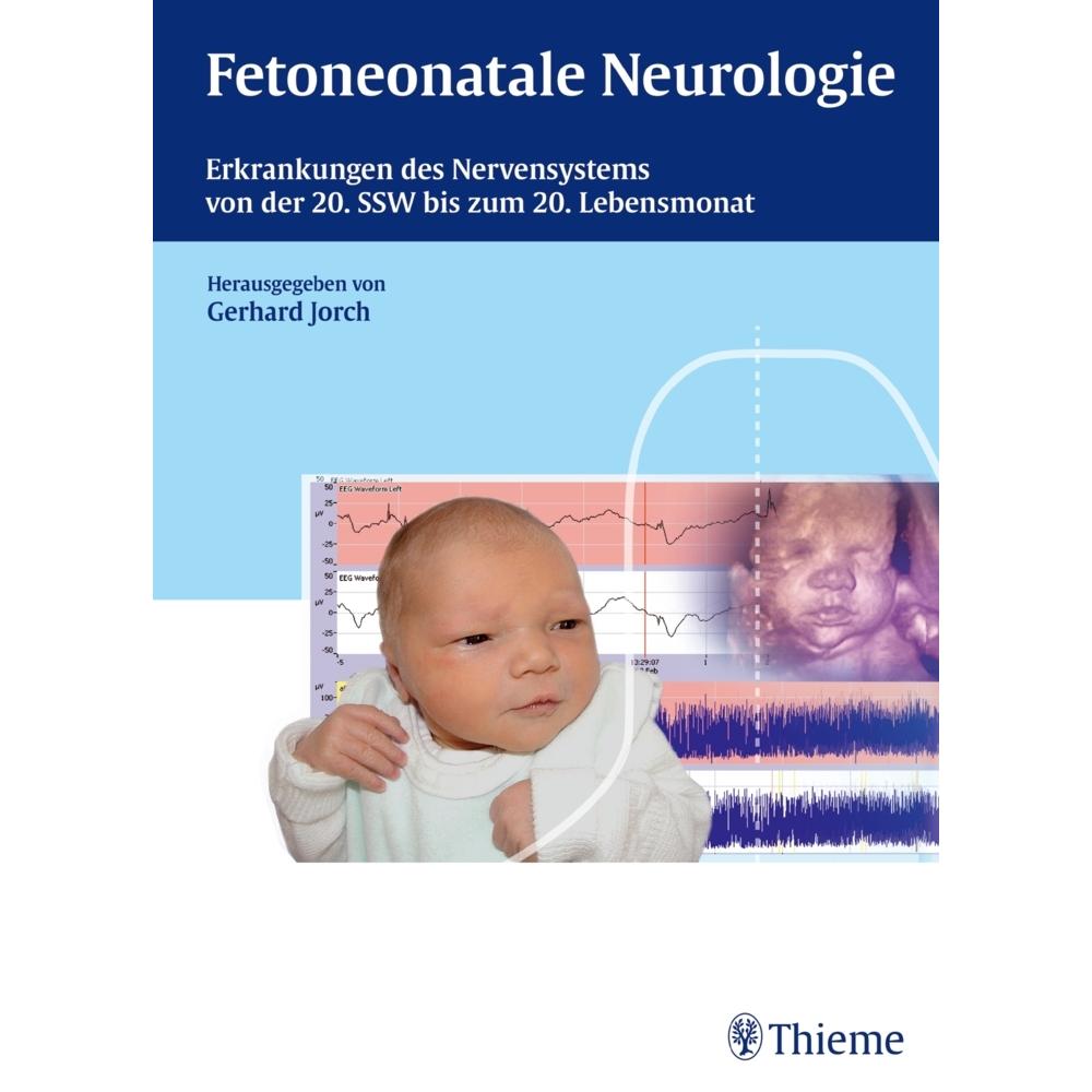 Fetoneonatale Neurologie, Fachbücher von Gerhard Jorch