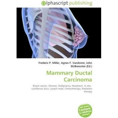 Mammary Ductal Carcinoma, Fachbücher von Agnes F. Vandome, Frederic P. Miller, John McBrewster