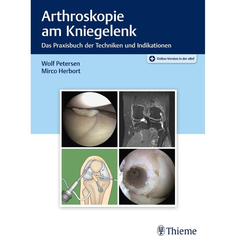 Petersen:Arthroskopie am Kniegelenk, Fachbücher