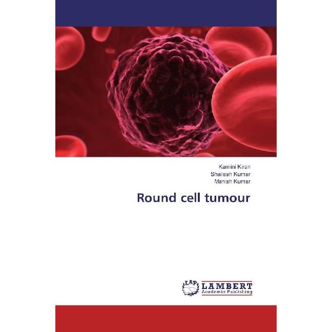 Round cell tumour, Fachbücher von Manish Kumar, Kamini Kiran, Shailesh Kumar