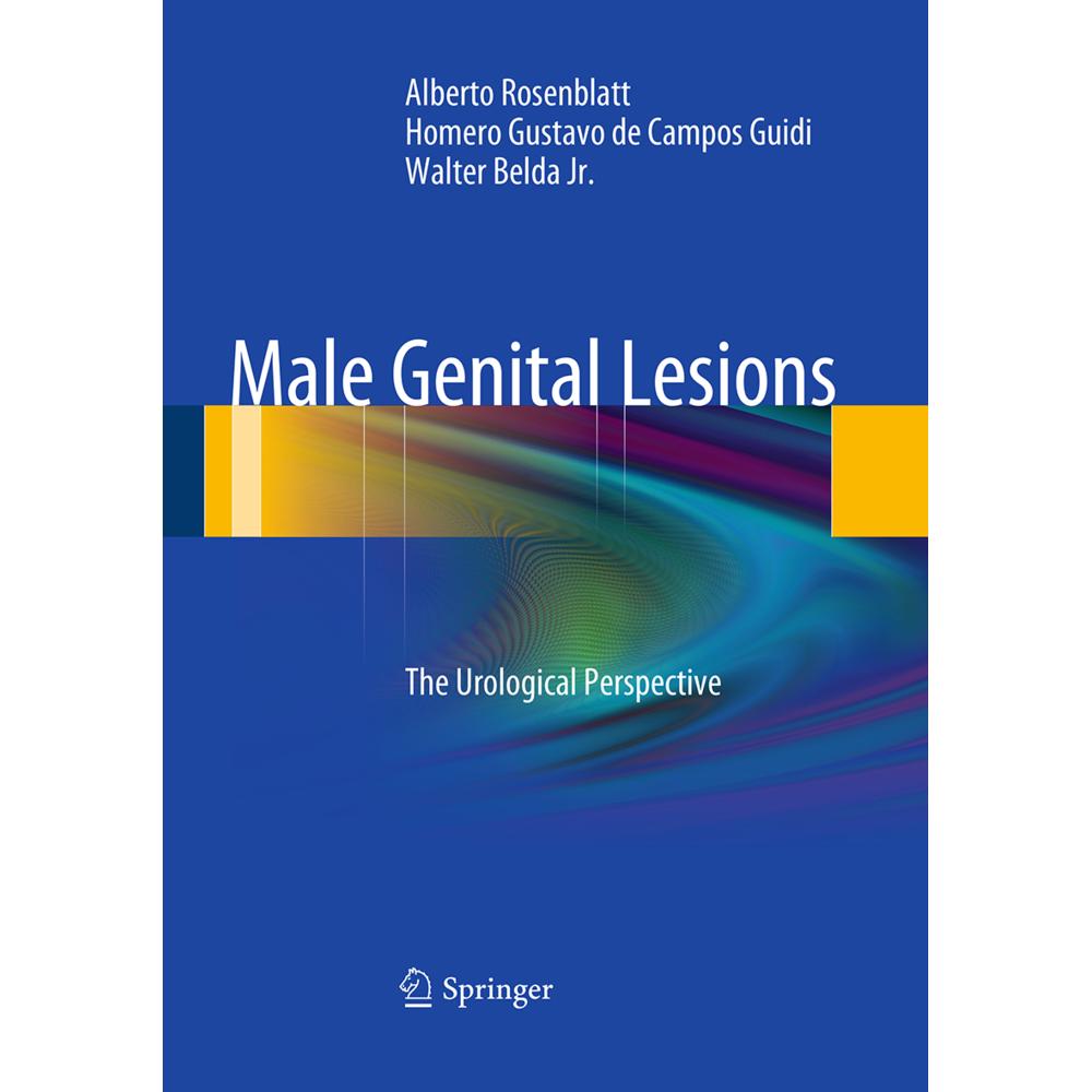 Male Genital Lesions, Fachbücher von Homero Gustavo de Campos Guidi, Alberto Rosenblatt, Walter Belda Jr.
