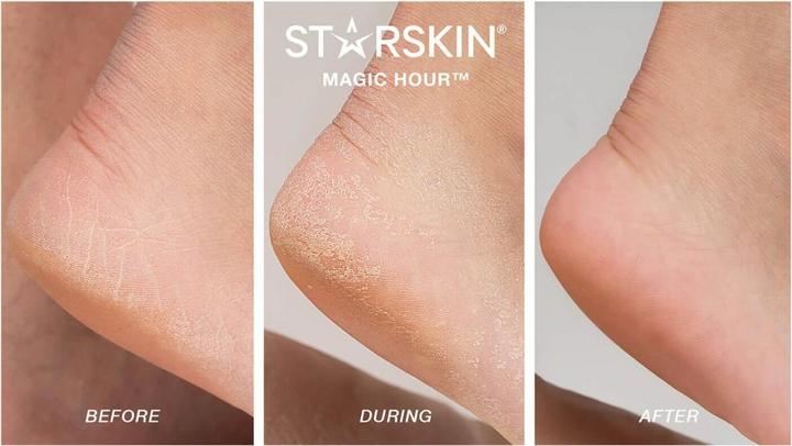 Immagine prodotto Starskin - Maschera esfoliante per piedi Magic Hour (Maschera del piede, 1 ml)
