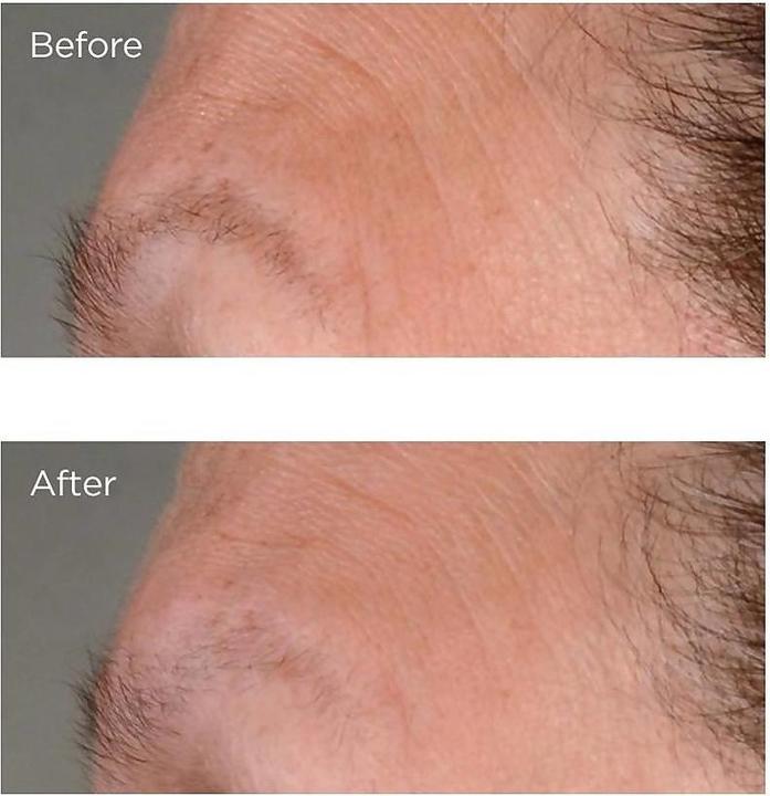 Produktbild Perricone MD High Potency Growth Factor Firm & Lifting Gesichtsserum 59 ml Frauen Frisch (59 ml)