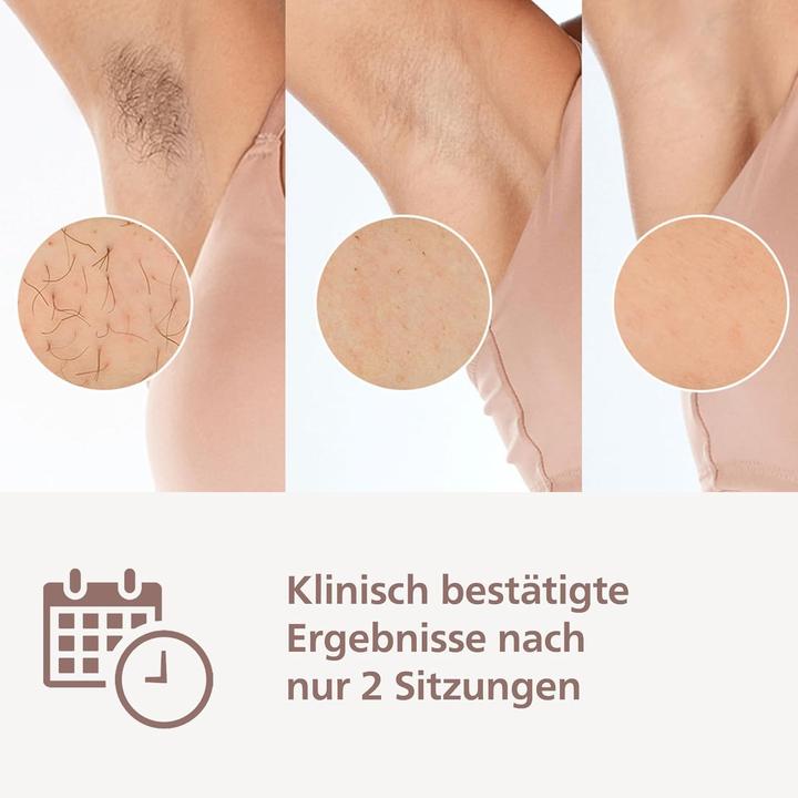 Actual product image Philips Lumea IPL Series 9900