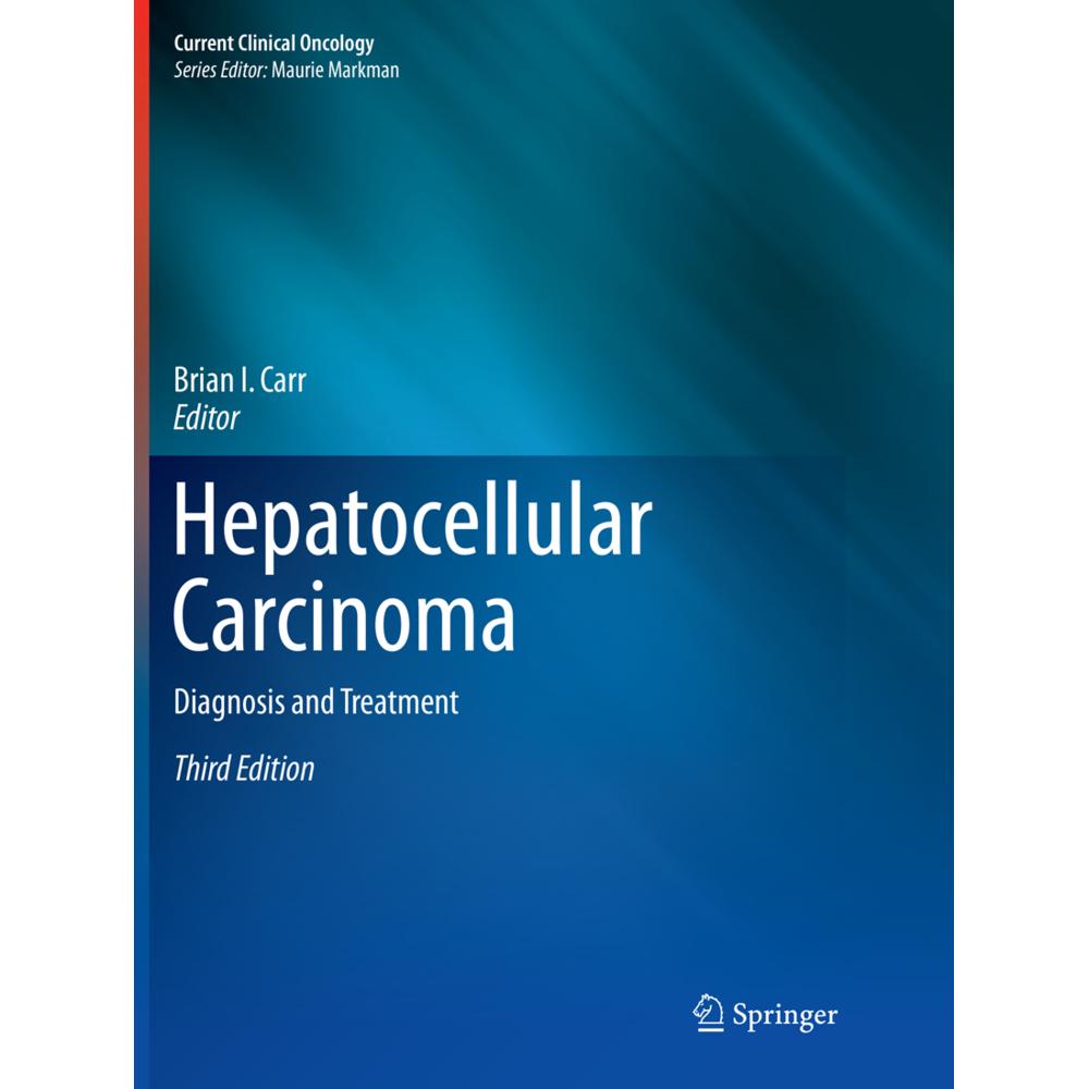 Hepatocellular Carcinoma, Fachbücher von Brian I. Carr