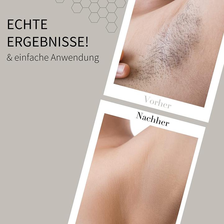 Image du produit Fleeky Kit de chauffage du fart (44 x, 870 g)