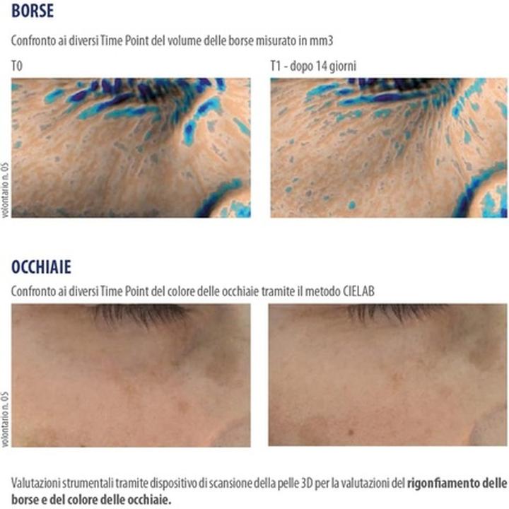 Actual product image Helan IREOS Eye Contour Dark Circles Lifting Effect Gel Serum with Cool Steel Roll On 10ml (Eye care gel, 10 ml, Day)