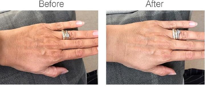 Actual product image Rio HandLite