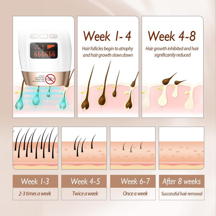 Produktbild TIMLand Epilierer mit Pulslicht