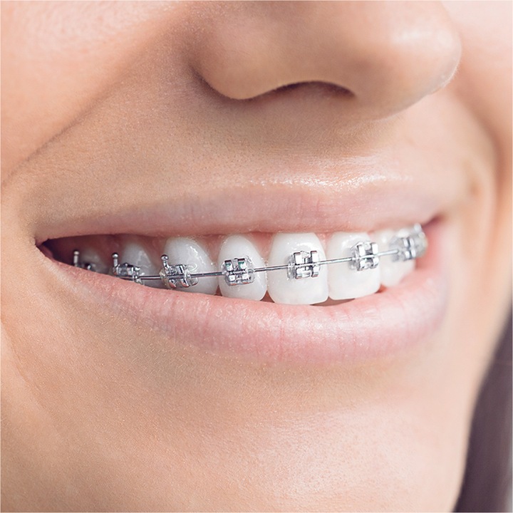 Actual product image Oral-B Ortho Care Essentials Kit (3 x)