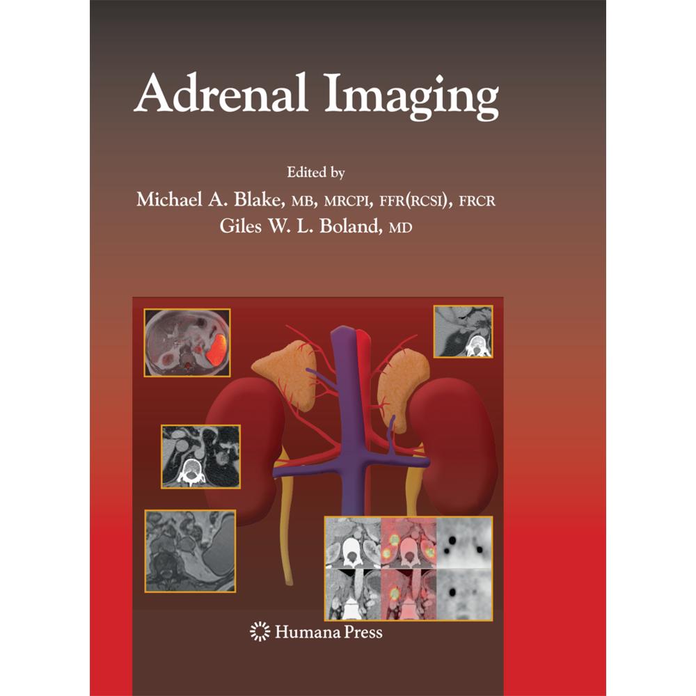 Adrenal Imaging, Fachbücher von Michael A. Blake, Giles Boland