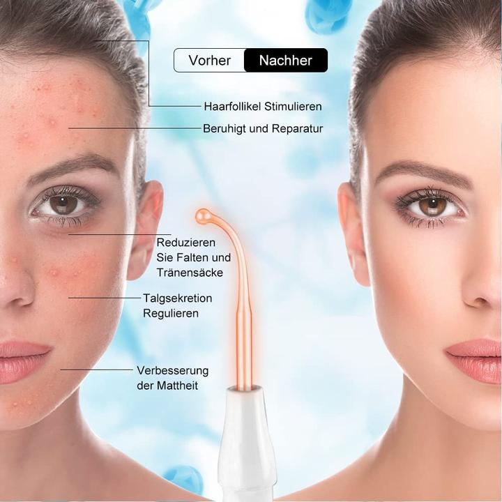 Actual product image Aoko High Frequency Wand 4 in 1 Portable White