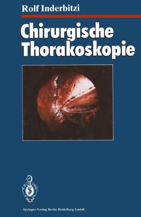 Produktbild Chirurgische Thorakoskopie (Deutsch, Rolf Gilbert Carl Inderbitzi, 2013)