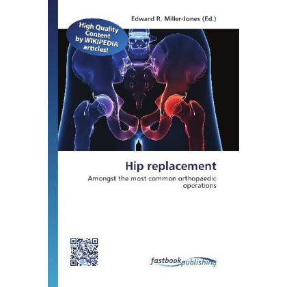 Hip replacement, Fachbücher von Edward R. Miller-Jones