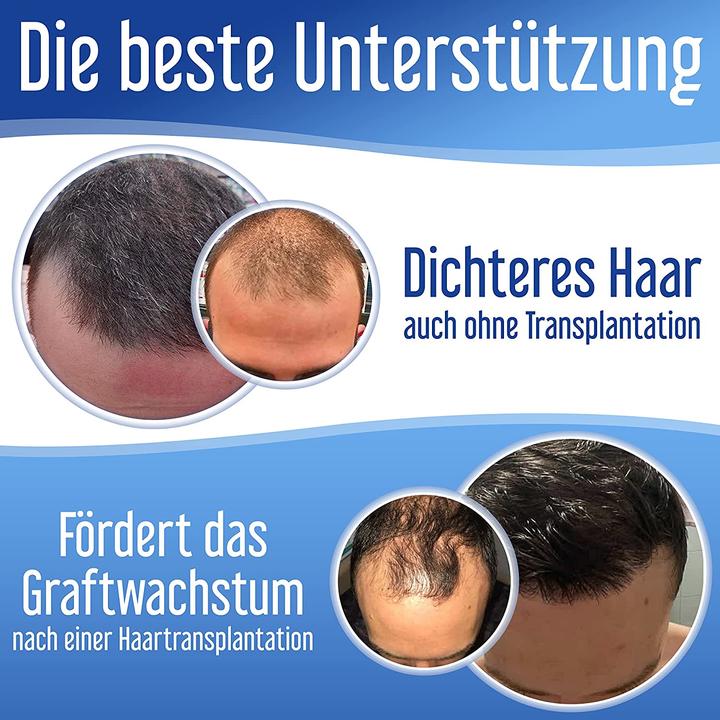 Image du produit Xpecia Bloqueur de DHT