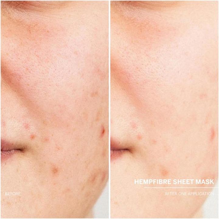Produktbild Babor DOCTOR - Hemp Fiber Sheet Mask