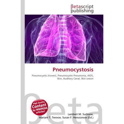 Pneumocystosis, Fachbücher von Lambert M. Surhone, Mariam T. Tennoe, Susan F. Henssonow
