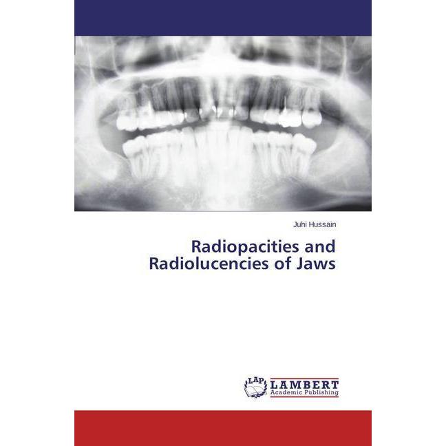 Radiopacities and Radiolucencies of Jaws, Fachbücher von Juhi Hussain