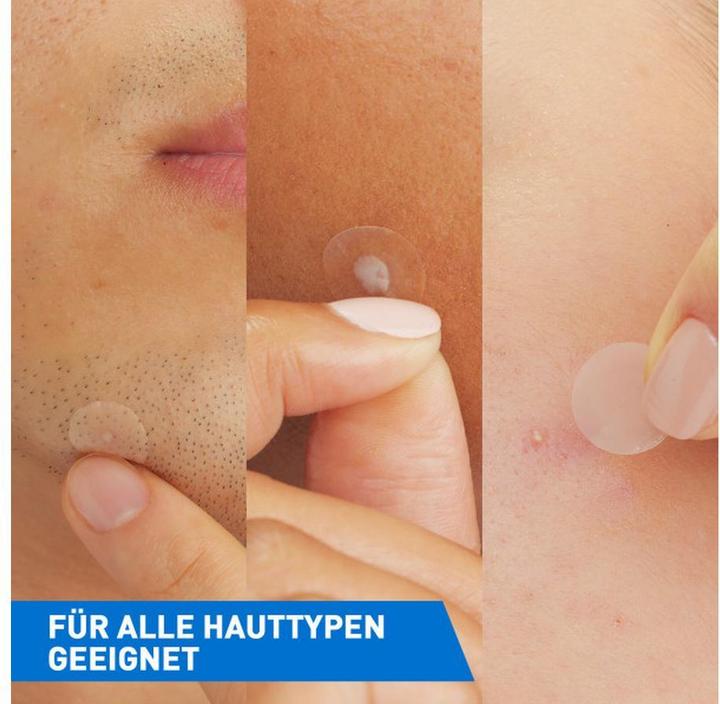 Produktbild CeraVe Anti-Unreinheiten Patches