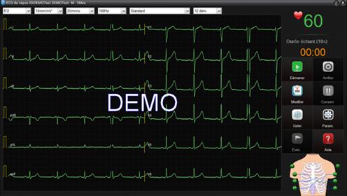 Image du produit Edan ECG de repos SE-1515 DP12 (USB)