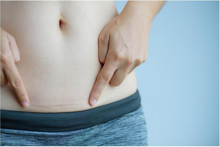 Actual product image Hansaplast Narben Reduktion (21 x)