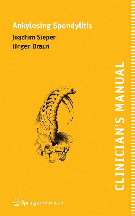 Produktbild Clinician's Manual on Ankylosing Spondylitis (Englisch, Joachim Sieper, Jürgen Braun, 2011)