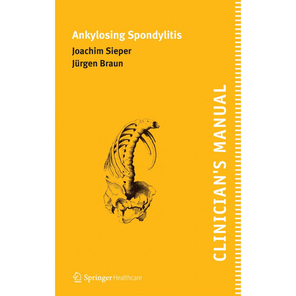 Thumbnail - Clinician's Manual on Ankylosing Spondylitis, Sachbücher von Joachim Sieper, Jürgen Braun