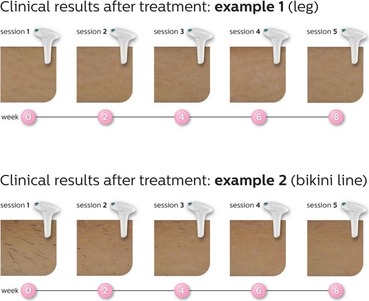 Actual product image Philips Lumea Advanced