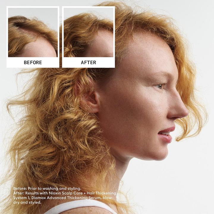 Actual product image Nioxin Scalp Revitaliser for System 1 (1000 ml)