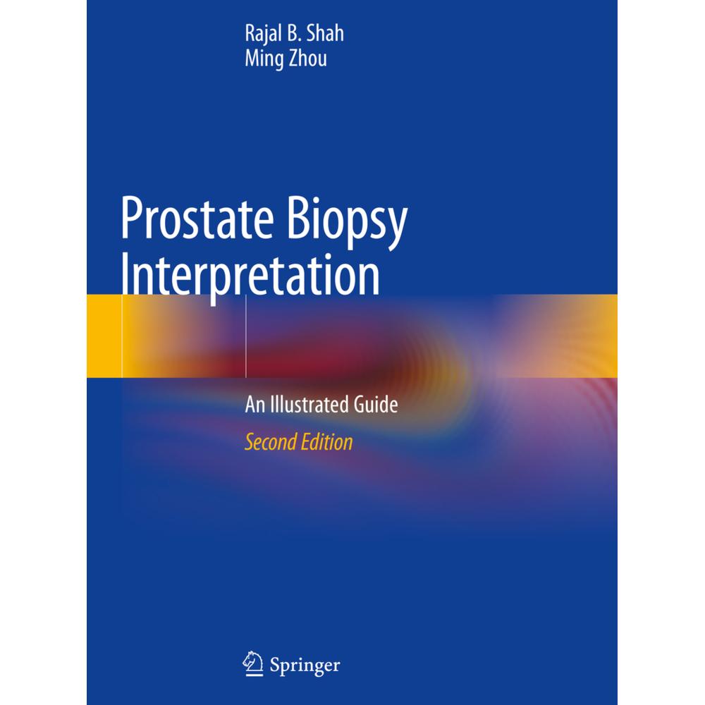 Prostate Biopsy Interpretation, Fachbücher von Ming Zhou, Rajal B. Shah