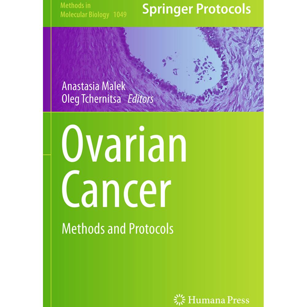 Ovarian Cancer, Fachbücher von Anastasia Malek, Oleg Tchernitsa