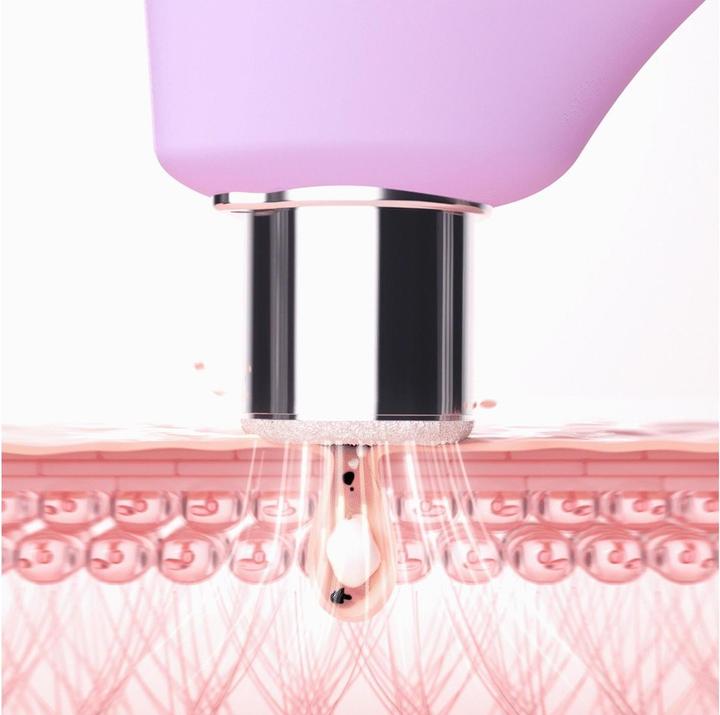 Actual product image Foreo Kiwi Derma