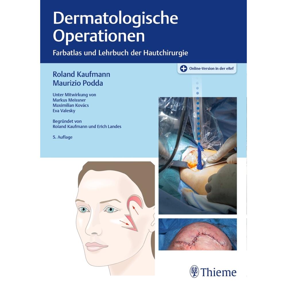 Dermatologische Operationen, Fachbücher von Roland Kaufmann, Maurizio Podda