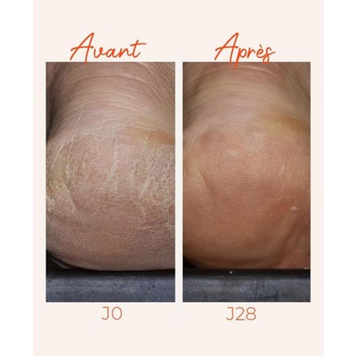 Image du produit Alvadiem Intense Dry & Fragilized Feet Protective Treatment 100ml (Bain de pieds, 100 ml)