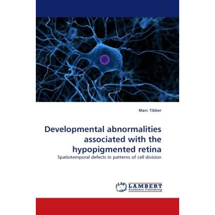 Thumbnail - Developmental abnormalities associated with the hypopigmented retina, Fachbücher von Marc Tibber