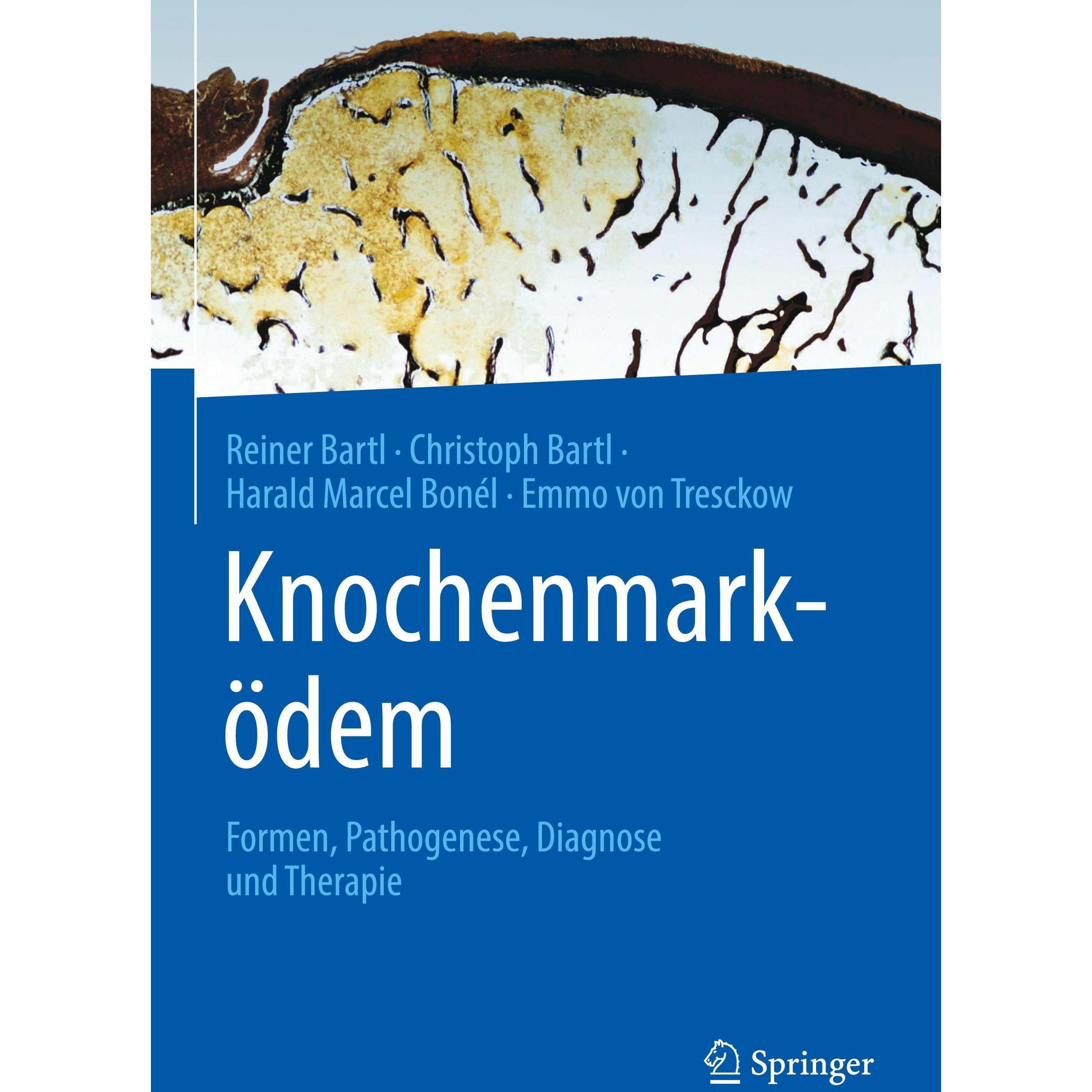Knochenmarködem, Fachbücher von Reiner Bartl, Harald Marcel Bonél, Emmo von Tresckow, Christoph Bartl