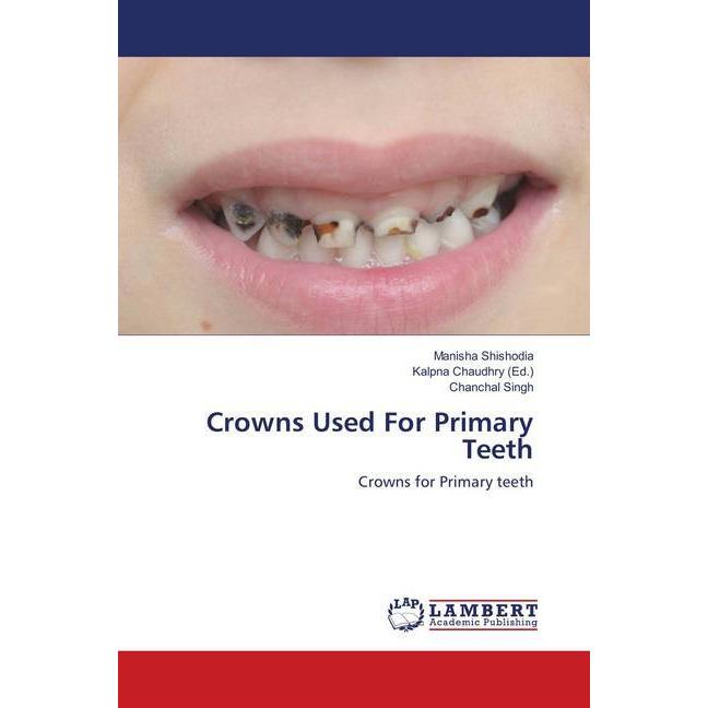 Crowns Used For Primary Teeth, Fachbücher von Chanchal Singh, Manisha Shishodia