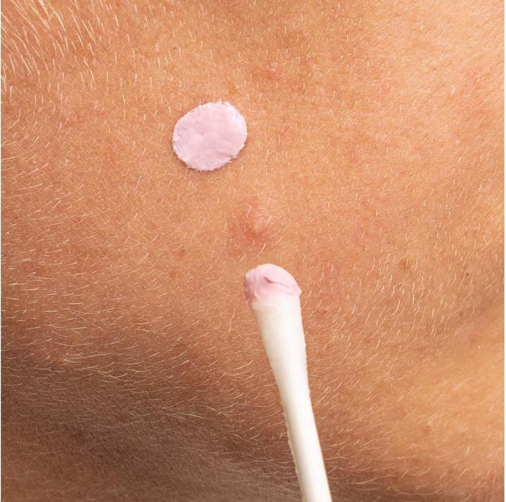 Image du produit Mizon Good Bye Blemish Spot rose (19 ml)