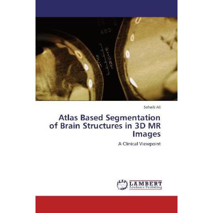 Atlas Based Segmentation of Brain Structures in 3D MR Images, Fachbücher von Sohaib Ali