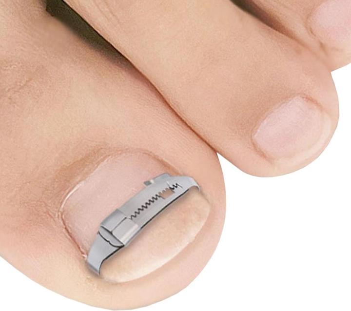 Produktbild JTI Nagelclip für eingewachsene Zehennägel