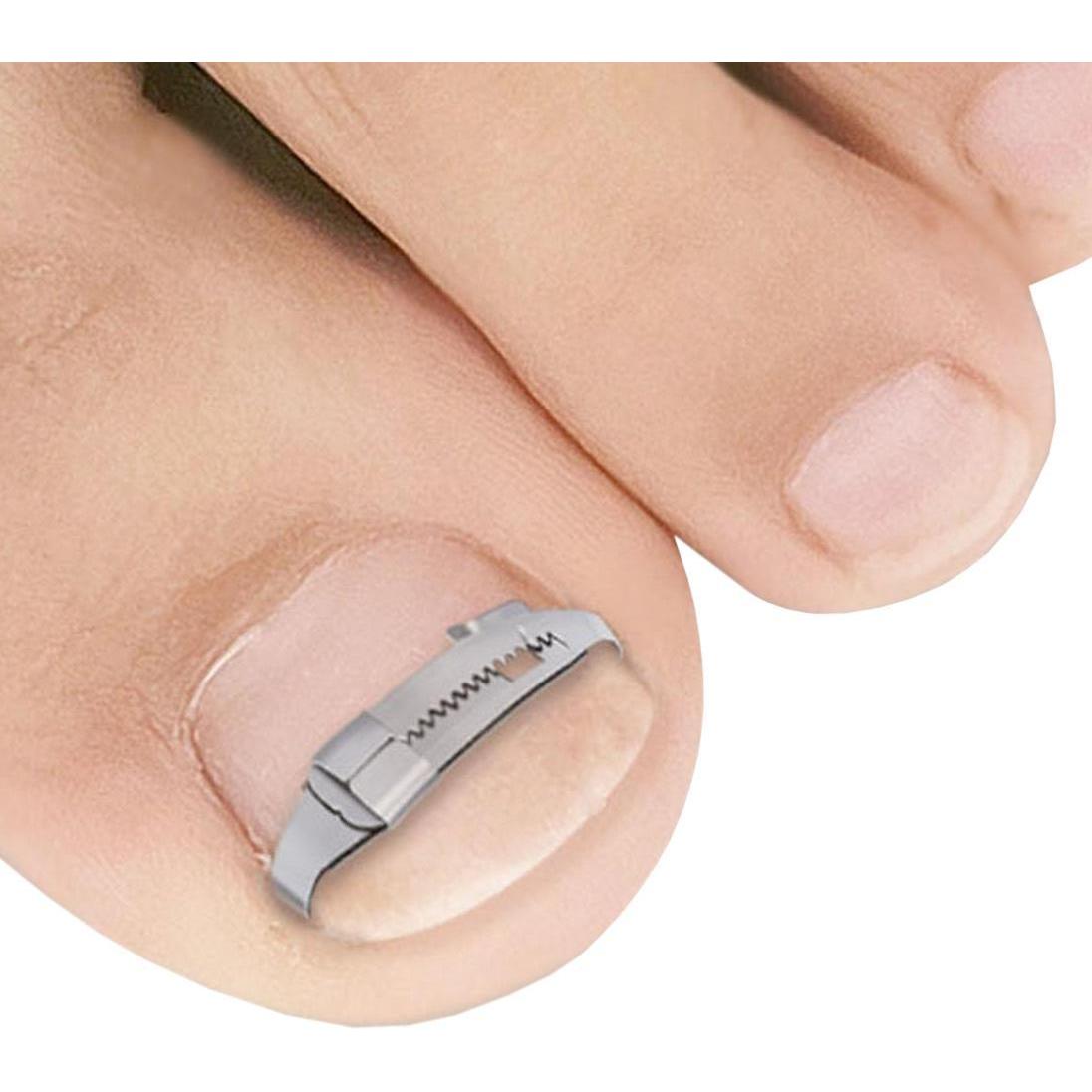 Thumbnail - JTI, Nagelpflegegerät, Nagelclip für eingewachsene Zehennägel